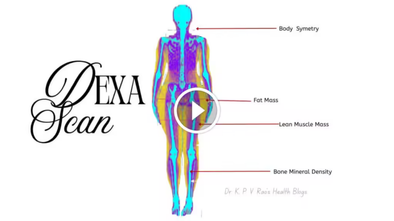 Healthy Weight Loss Approach -Dexa Scan- What Is It And How Does It Help You | uxa2.com Healthy Weight Loss Approach -Dexa Scan- What Is It And How Does It Help You | uxa2.com